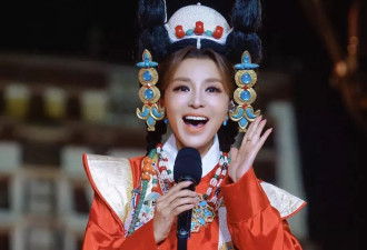 51岁朱迅变化大，上唇外翻疑做提唇手术
