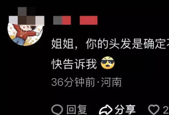 51岁朱迅变化大，上唇外翻疑做提唇手术
