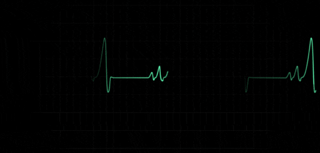 为什么猝死的年轻人越来越多？医生揭露6大共性