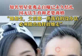 知名男星张兆志自曝已永久结扎！坦言因结扎无法生育和老婆离婚