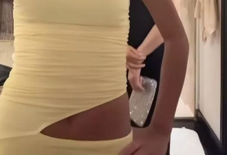 张庭母女同框，15岁林希曈穿黄色长裙更显黑了