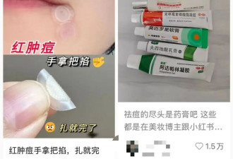 祛痘神器，美白秘方？吹爆小红书的护肤小窍门真有用？上海皮肤科医生揭秘