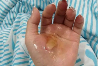 女子家中洗澡疑热水器漏电被电击 差一点救不回来