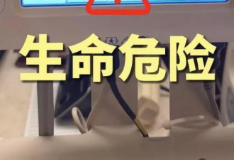 54岁胡兵在泰国做完手术，体内取出上百颗胆结石