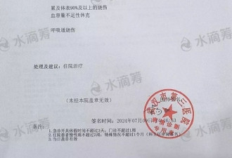 大学生因室友电瓶燃爆致90%烧伤，260余万善款将花光