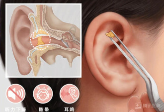 快住手！身体这部位太“干净”反而伤身