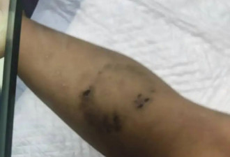 上海幼童遭生父女友虐待致死案将开庭！其母称...