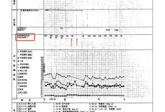 广东22岁女孩手术成功却在复苏室脑死亡