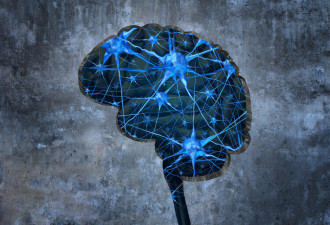 研究发现 有3个特征的人 更易患痴呆症