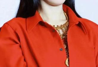  张柏芝鹅蛋脸变“包子”脸，网友：do脸了？ 