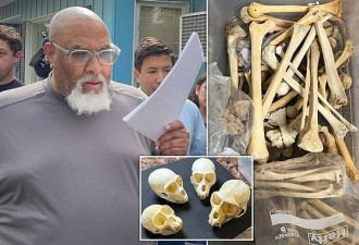 哈佛医学院太平间卖人体器官 前经理让买家随意挑