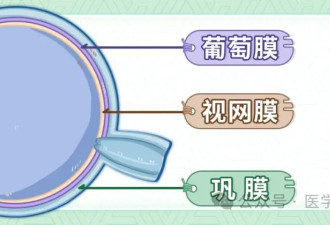要警惕这种眼内炎症 严重会致盲