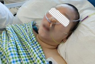 女子患脑膜瘤双目失明，15万理赔防癌险被拒！