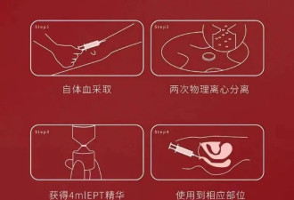 这不是段子！小红书上的独立女性正排队打高潮针