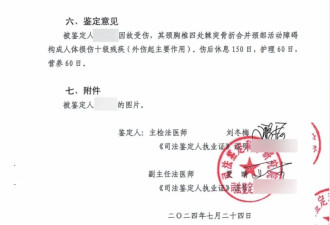 居民被脱落外墙瓦砖砸中致十级伤残,物业赔付16万