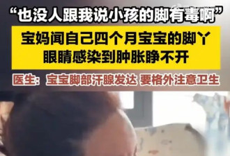 演员吴悦菡闻孩子脚丫导致眼睛感染 最终确诊细菌性结膜炎