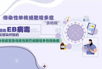 4岁男孩高烧不退，一查竟是得了“亲吻病”