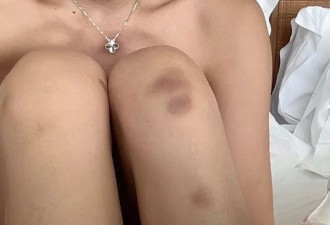 在马尔代夫遭酒店管家性侵 中国女子发长文