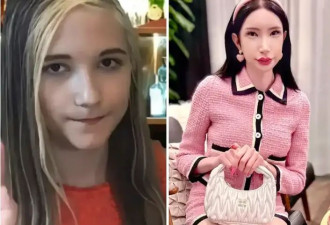  奥地奥地利白女网红梦想当韩女，竟全脸爆改缝单眼皮？ 