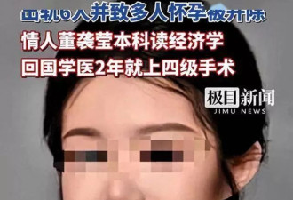 董小姐整容前照片：长相一般，脸盘子大