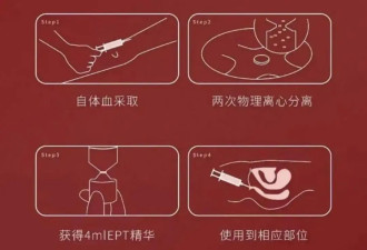 少妇们热搜的“高潮针”，到底让谁“高潮”！
