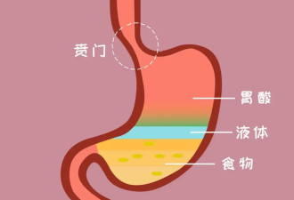 出现这些症状 小心胃食管反流