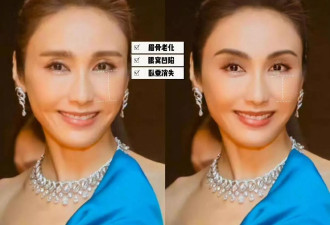 55岁黎姿日本赏樱，脸部僵硬令人惋惜