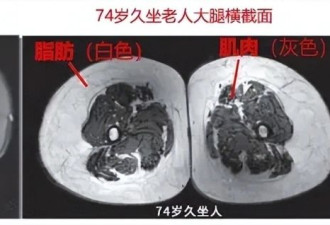 被骗多年！运动加速衰老or延缓衰老？