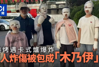 烧烤遇炉子爆炸 7人被炸伤 包成“木乃伊”