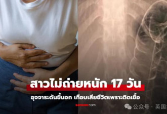 台湾女便秘竟憋到“吐翔” X光显示塞满胸腔
