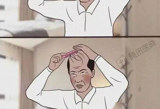 经常梳头 vs 不怎么梳头 到底哪种更健康？