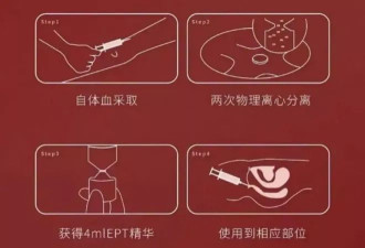 上热搜的“高潮针”，到底让谁“高潮”？