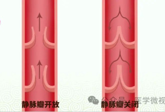腰痛、腹痛？别总以为是累的 一定要警惕这种病