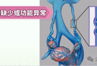 腰痛、腹痛？别总以为是累的 一定要警惕这种病