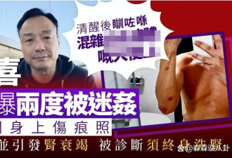王喜自曝在台湾遭迷奸 醒后全裸趴大便上