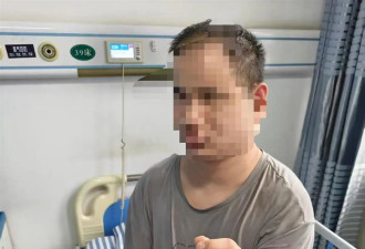 盲人体验小米汽车导致手指骨折 小米表示已走保险