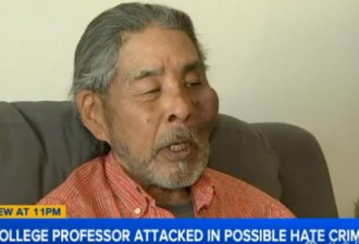南加教授讲了一辈子“种族歧视” 却被撞伤怒骂