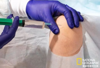 医学颠覆性突破：你身体的器官或许真的可以再生了