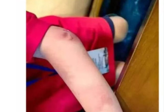 杭州9岁围棋少年疑遭父亲家暴跳楼身亡