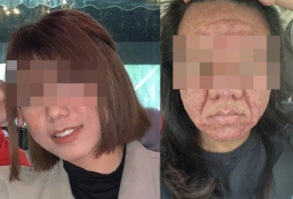 怀孕8个月 准妈照镜子崩溃不已：变另一个人…