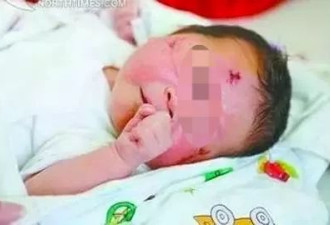 厦门车祸“奇迹宝宝”11岁了：孩子五年来首次见到外婆