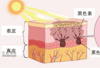 什么样的痣会“癌变”?符合5个特征要警惕