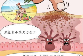 什么样的痣会“癌变”?符合5个特征要警惕