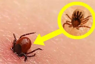 高！度！警！惕！这种小虫“一咬致命”！夏季高危！