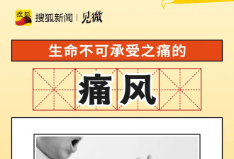 30岁60岁的血管 年轻人患老年病为什么这么普遍?
