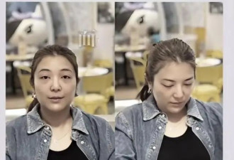 担心!TVB视帝妻子晒近况,面部肿到认不出,状态差