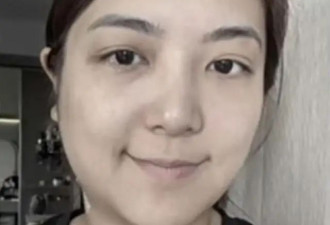 担心!TVB视帝妻子晒近况,面部肿到认不出,状态差