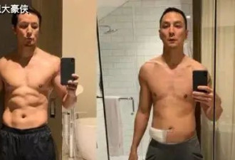 陈乔恩确诊盲肠炎，手术在肚子上打3个洞，此前吴彦祖差点因此病丧命