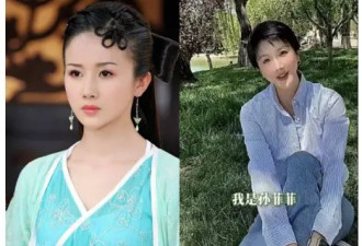 女星曾因变丑引群嘲 自曝：是患这种病 专偷颜值