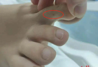 27岁女子被毒蛇咬伤送医身亡？更多细节公布